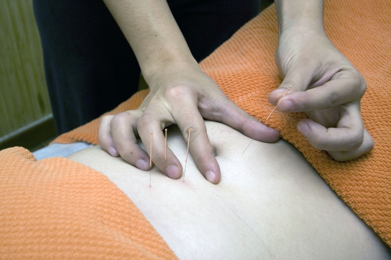 osteopathe-REVEST LES ROCHES-min_acupuncture-4175625